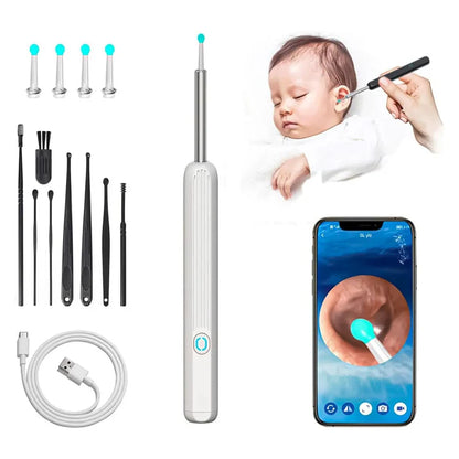 1080P HD Smart Earwax Removal Kit – Safe & Easy Cleaning